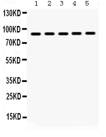 WB - Anti-Hsp90 Beta Picoband Antibody ABO12322